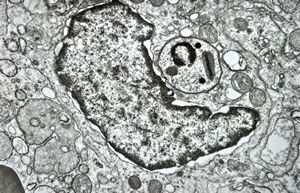 M, 28y. | leishmaniosis … skin of the cheek